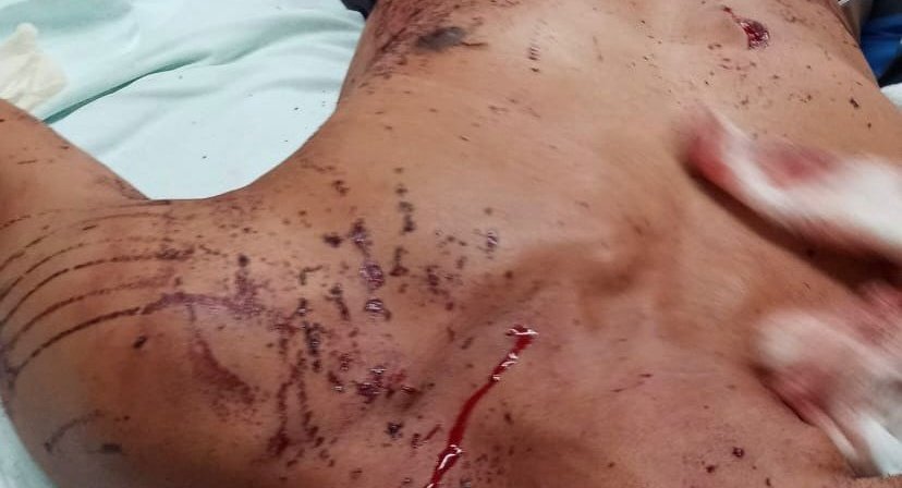 Homem é esfaqueado após briga entre familiares em Nova Andradina